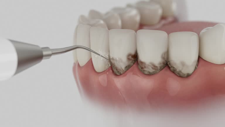 Trusted Root Canal Treatment service in Whitesboro, TX - Dentist Open Now